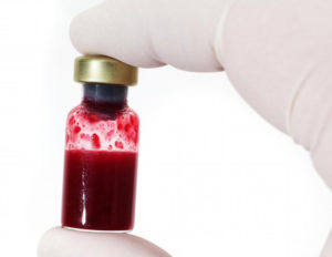 При анемии необходимо сдать общий анализ крови
